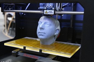 Tái tạo xương chậu bằng công nghệ in 3D